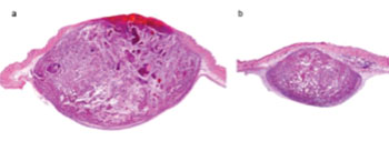 Image: Histological section of two mouse melanomas: (a) untreated and (b) treated with sitagliptin, a specific DPP4 inhibitor (Photo courtesy of Institut Pasteur).