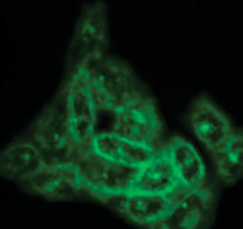 Image: Cholesterol–shown here in hamster ovary cells—is a building block of steroid hormones that trigger puberty and support pregnancy (Photo courtesy of Dr. D. Ory, Washington University School of Medicine).