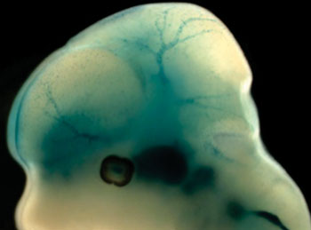 Image: The photomicrograph shows the head of a mouse embryo in which the pericytes are visible as blue dots along the blood vessel (Photo courtesy of the University of Gothenburg).