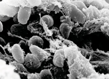 Image: Scanning electron microscope micrograph showing a mass of Yersinia pestis bacteria in the foregut of an infected flea (Photo courtesy of the [US] National Institutes of Health).