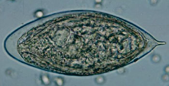 Image: Egg of Schistosoma haematobium in a wet mount of urine concentrates, showing the characteristic terminal spine (Photo courtesy of Centers for Disease Control and Prevention).