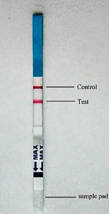Image: An immunochromatographic strip tested with a serum sample from a visceral leishmaniasis patient, both the control and the test line turned pink (Photo courtesy of Chinese National Institute of Parasitic Diseases).