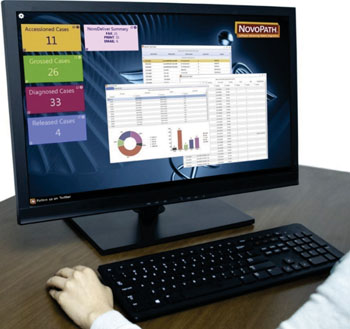 Image: The new NovoPath Dashboard adds at-a-glance, “real-time” monitoring capability for anatomic pathology lab managers to assess operational data on the NovoPath platform, enabling to better anticipate bottlenecks and avoid potential problems (Photo courtesy of NovoPath).