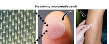 Image: The microneedle patch can dissolve in the skin, delivering the flu vaccine painlessly (Photo courtesy of Dr. Shinsaku Nakagawa, Osaka University).