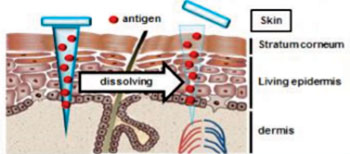 Image: The microneedle patch can dissolve in the skin, delivering the flu vaccine painlessly (Photo courtesy of Dr. Shinsaku Nakagawa, Osaka University).