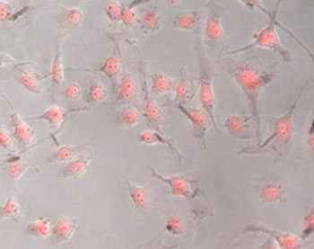 Image: The cells in this image have turned fluorescent pink, showing that the new drug delivery system results in high cellular uptake after being irradiated by near infrared light (Photo courtesy of Dr. Jennifer West, Duke University).