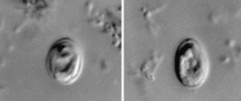 Image: Nomarski interference contrast photomicrographs of Cryptosporidium in the feces of an HIV-positive human (Photo courtesy of the CDC - [US] Centers for Disease Control and Prevention).
