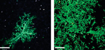 Image: New lung cells are continuously created to replace the damaged ones: Lung tissue six weeks after stem cell transplantation (left) and 16 weeks after transplantation (right). Cells that originated in the transplanted stem cells are green, as opposed to the uncolored host lung cells (Photo courtesy of the Weizmann Institute of Science).