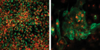 Image: Researchers have generated disease-free stem cells from patients with mitochondrial disease that can be converted into any cell type including neuronal progenitors (left) or heart cells (right). These could potentially be used for future transplantation into patients (Photo courtesy of Salk Institute of Biological Studies).