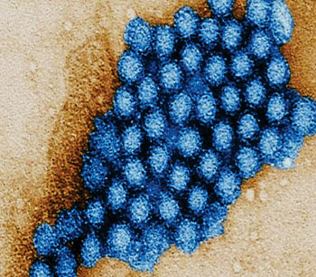 Image: Transmission electron micrograph (TEM) of norovirus virions, or virus particles (Photo courtesy of Charles D. Humphrey/CDC).