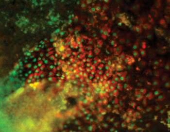 Image: Photomicrograph shows emergence of stem cell-derived hepatocytes (Photo courtesy of Dr. Yaakov Nahmias, Hebrew University of Jerusalem, Israel).
