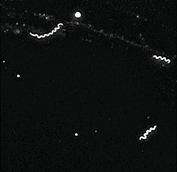 Image: Borrelia miyamotoi spirochetes from the cerebrospinal fluid of a patient with meningoencephalitis using dark-field microscopy (Photo courtesy of Tufts University).