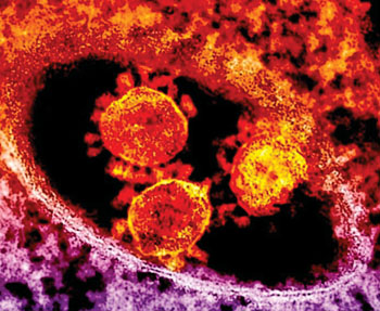 Image: Highly-magnified, digitally-colorized transmission electron micrograph (TEM) of a number of red-colored, spherical-shaped Middle East Respiratory Syndrome Coronavirus (MERS-CoV) virions (Photo courtesy of NIAID – [US] National Institute of Allergy and Infectious Diseases).