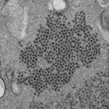 Image: Electron micrograph of a thin section of EV-D68, showing the numerous, spherical viral particles (Photo courtesy of the CDC - [US] Centers for Disease Control and Prevention).