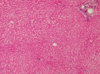Image: Cross-section of the human liver (Photo courtesy of Wikimedia Commons).
