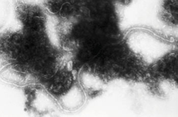 Image: Electron micrograph showing the respiratory syncytial virus (RSV) pathogen. RSV is a negative-sense, enveloped RNA virus (Photo courtesy of the CDC - [US] Centers for Disease Control and Prevention).