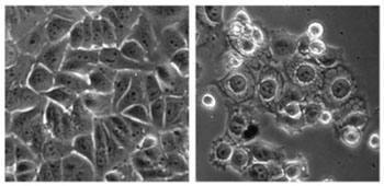 Image: Cancer cells were treated with a control (left) and the overstimulating compound MCB-613 (right) (Photo courtesy of Dr. Lei Wang, Baylor University College of Medicine).