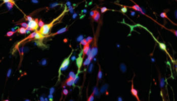 Image: Cells with a nucleus (labeled blue), were originally human fibroblasts, some of which have been converted to neurons that produce serotonin (green) while others have been converted to produce another neuron-specific protein. Yellows, greens, and other colors result from overlapping labels (Photo courtesy of Dr. Jian Feng, University at Buffalo).