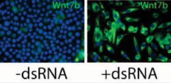 Image: Skin cells (keratinocytes) treated with an agent that activates TLR3 (dsRNA) can turn on important regeneration proteins, like Wnt7b (green) (Photo courtesy of Johns Hopkins University).