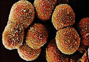Image: Scanning electron micrograph of Hepatitis C viruses (Photo courtesy of Cardiff University).