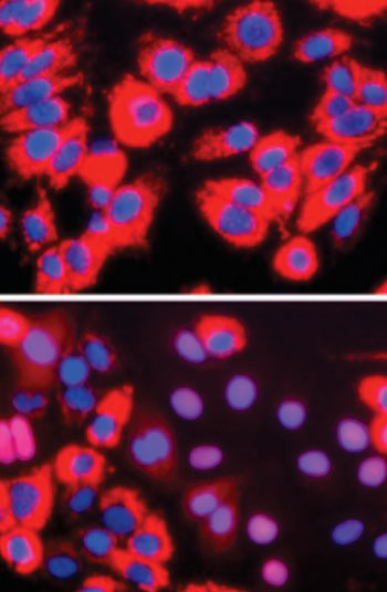Image: Researchers engineered cultured cells to contain a red marker that moves into the nucleus upon HCV infection. Nothing happened when normal cells were exposed to HCV (top), but when the researchers expressed the protein SEC14L2, some nuclei changed color from blue to purple (bottom) (Photo courtesy of Laboratory of Virology and Infectious Disease at The Rockefeller University).
