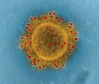 Image: Middle East Respiratory Syndrome Coronavirus (MERS-CoV) particle envelope proteins immunolabeled with rabbit HCoV-EMC/2012 primary antibody and goat anti-rabbit 10 nanometer gold particles (Photo courtesy of the [US] National Institute of Allergy and Infectious Diseases).