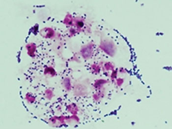 Image: Gram stain of Streptococcus agalactiae or group B streptococcus (Photo courtesy of Institut Pasteur).