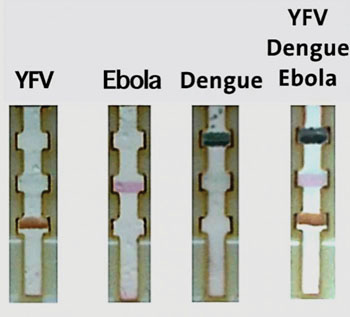 Image: The paper-strip test differentiates Ebola, dengue and yellow fever (Photo courtesy of Dr. Chun-Wan Yen).