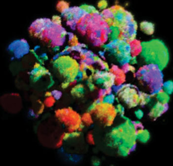Image: A three-dimensional model of a tumor showing cell types in varying colors (Photo courtesy of Dr. Bartlomiej Waclaw and Dr. Martin A. Nowak, the University of Edinburgh).