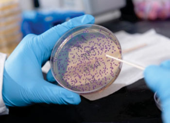 Image: Plate containing E. coli producing a purple pigment indicative of low levels of zinc. The bacterium could be used to detect nutritional deficiencies in resource-limited areas of the world (Photo courtesy of Rob Felt, Georgia Institute of Technology).