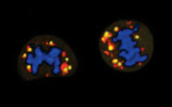 Image: During the process of cell division, the mitochondria are damaged (yellow indicator) making the cells particularly dependent on glucose as a source of energy. Genetic material is shown in blue and mitochondria in red (Photo courtesy of the Spanish National Cancer Research Center).