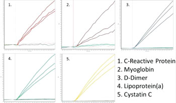 Image: For five (1-5) diagnostic antibodies: specific-binding curves of Total IgY in a complex protein solution binding to immobilized antigen. Data provide direct information about the specificity of three different production batches, highly valuable information especially for development of diagnostic assays. Curves for all antigen spots are shown. Binding of IgY is observed only to its respective immobilized antigen. (Photo courtesy of Sanovo Biotech).