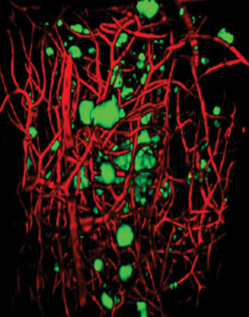 Image: A three-dimensional visualization of A-beta plaques (green) and blood vessels (red) in a region of cerebral cortex from a 20-month-old Alzheimer\'s disease model mouse (Photo courtesy of RIKEN Brain Science Institute).