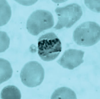Image: Photomicrograph of a band-form trophozoite of P. malariae in a thin blood smear (Photo courtesy of the CDC – [US] Centers of Disease Control and Prevention).