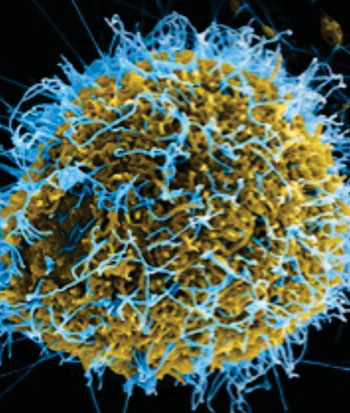 Image: A new test can detect virtually any virus that infects people and animals, including the Ebolavirus depicted in this enhanced electron micrograph (Photo courtesy of the [US] National Institute of Allergy and Infectious Diseases).