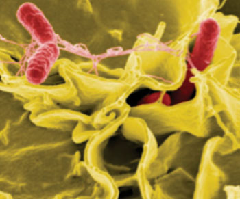 Image: Scanning electron micrograph of Salmonella enterica (shown in red) (Photo courtesy of the [US] National Institute of Allergy and Infectious Diseases).