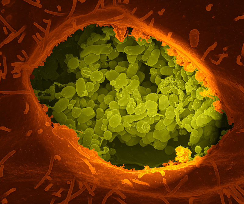 Image: A dry fracture of a Vero cell exposing the contents of a vacuole where Coxiella burnetii, the causative agent of Q fever, are rapidly growing (Photo courtesy of National Institutes of Health).