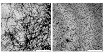 Image: Electron micrograph of beta-amyloid in the absence (left) and presence (right) of alpha-B-crystallin (Photo courtesy of Dr. Andi Mainz, Technical University of Munich).