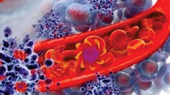 Технология Nucleosomics: ДНК в каждой клетке намотана вокруг белкового комплекса, образуя структуру `бусин на нити`. Каждая `бусина` называется нуклеосомой. Когда клетки погибают, организм разбивает цепи ДНК на отдельные нуклеосомы, которые выделяются в кровь (фото любезно предоставлено VolitionRx Limited).