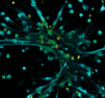 Image: Neutrophils produce bacteria-ensnaring NETs (shown in blue/green) in response to tamoxifen treatment (Photo courtesy of the University of California, San Diego).