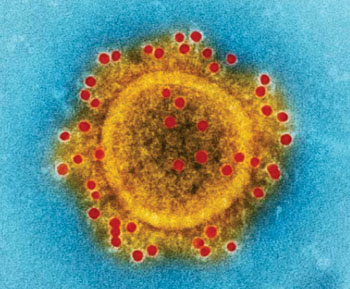 Image: Transmission electron micrograph (TEM) highlights the particle envelope of a single, spherical-shaped Middle East Respiratory Syndrome Coronavirus (MERS-CoV) virion (Photo courtesy of US National Institute of Allergy and Infectious Diseases).