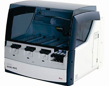 Image: The Bond-Max automated immunostainer (Photo courtesy of Leica Biosystems).
