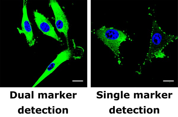 Image: Researchers have developed a technique that detects a pair of markers for glioblastoma, a type of brain cancer. Left: Cancerous cells are marked with green (blue shows cell nucleus but does not indicate cancer). Right: When only epidermal growth factor receptor is detected in the same sample, the cancer signal is much less obvious (Photo courtesy of Weibo Cai laboratory, University of Wisconsin).
