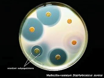 Image: Disk diffusion susceptibility test on methicillin-resistant Staphylococcus aureus with co-trimoxazole (susceptible), erythromycin (resistant), clindamycin (resistant), gentamicin (susceptible), cefoxitin (resistant), and tetracycline (susceptible) (Photo courtesy of Bacteriainphotos).