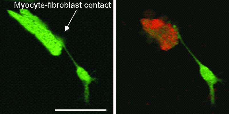 Image: Micrographs show a cardiac myocyte cell (top) and an attached fibroblast cell (bottom) in a rat heart, after the injection of the newly developed nanoparticle. In the second frame, red light has been applied. The red coloring indicates that the myocyte, which causes cardiac arrhythmia, has been killed, while the fibroblast remains unharmed (Photo courtesy of the University of Michigan).