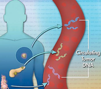 Image: Schematic diagram of circulating tumor DNA (ctDNA), a small piece of DNA released from dying cancer cells into the blood (Photo courtesy of Jonathan Bailey).