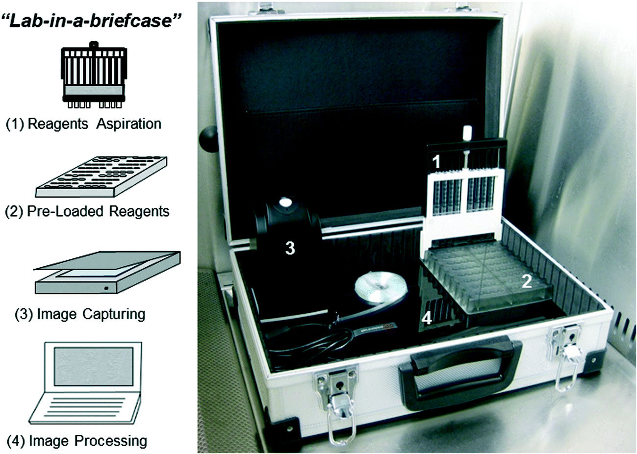 Image: The 4 main components of the newly developed “lab-in-a-briefcase.” (1) Disposable multiple syringe aspirator (MSA) devices, each of which can perform 10 replicate ELISA tests on each of the 8 samples. (2) Customized microwell plates preloaded with reagents that interface with the MSA. (3) Portable USB-powered film scanner for colorimetric signal quantification. (4) Portable computer for real-time data analysis (Photo courtesy of Barbosa AI et al., 2015, and the journal Lab on a Chip.)