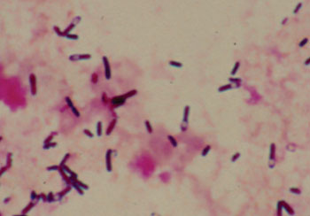 Image: Micrograph of the Gram-positive bacillus C. sporogenes (Photo courtesy of the University of Pennsylvania).
