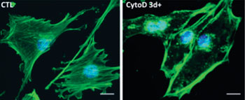 Image: Left: Green actin fibers create architecture of the cell. Right: With cytochalasin D added, actin fibers disband and reform in the nuclei (Photo courtesy of the University of North Carolina).