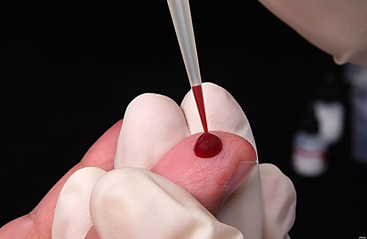 Image: Blood obtained via fingerstick is commonly used in point-of-care assays (Photo courtesy of The Health).
